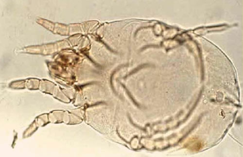 Dermatophagoides pteronyssinus